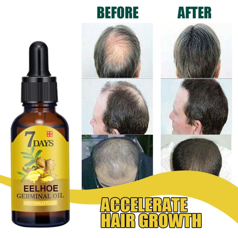 Great Ginger Hair Tonic 7-day Ginger Hair Oil Hair Loss Treatment Fast Growing Nourishing And Hydrating Hair Care TSLM2